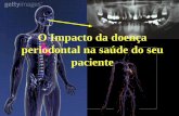 O Impacto da doença periodontal na saúde do seuperiodontiamedica.com.br/wp-content/uploads/2013/06/periodontia... · Doença Periodontal Fatores de risco Homeostasia sistêmica