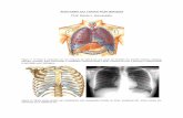 ANATOMIA DO TÓRAX POR IMAGEM Prof. Dante L. Escuissatodapi.com.br/wp-content/uploads/2018/11/anatomia-do-torax.pdf A TCAR permite que se identifiquem estruturas vasculares de menor