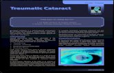Ocular Trauma Traumatic Cataract - DOS TIMES · Ocular Trauma Traumatic Cataract Ocular Trauma Vishal Arora MD Cataract formation is a well-recognized consequence of blunt and penetrating