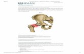 La frattura dell'anca - Homepage - …sergioportella.altervista.org/alterpages/files/La...In caso di frattura del femore è sempre necessario intervenire chirurgicamente? 5. In che