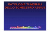 PATOLOGIE TUMORALI DELLO SCHELETRO ASSILEfisiokinesiterapia-news.it/download/tumschele.pdf · tumori ossei vertebrali primitivi secondari • benigni •emangioma ed•oom ooieaettss