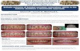 Chieti, 21-23 Aprile 2010 - Malchiodi · Esthetic outcome of bonded porcelain restorations (BPR) in the anterior dentition: a biomimetic approach. Sezione di Chirurgia Maxillo-Facciale