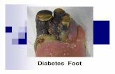 Diabetes Foot - medkorat.in.th Foot.pdf · (Tinea pedis) ˇ˘˛>MB F ˛ˆ >? ˆ4 ... Dorsum of interphalangeal joints Heel Surrounded by callus. Ischemic Ulcer Painful Situated on