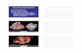 MATURE TERATOMAS - c.ymcdn.com · PDF fileStruma with Dermoid Cystic Struma. Cystic Struma Cystic Struma Solid Struma. Struma Carcinoid Insular Carcinoid. PRIMITIVE GERM CELL TUMORS