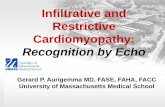 Infiltrative and Restrictive Cardiomyopathy Cardiomyopathy •Least common of the cardiomyopathies •The cardiac chambers cannot stretch normally = stiff/noncompliant •Filling at