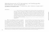 Multichannel CT Imaging of Orthopedic Hardware and Implants · Multichannel CT Imaging of Orthopedic Hardware and ... metal hardware cause more attenuation and more arti- ... MULTICHANNEL