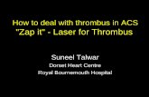 How to deal with thrombus in ACS Zap it - Laser for Thrombus · How to deal with thrombus in ACS "Zap it" - Laser for Thrombus Suneel Talwar Dorset Heart Centre Royal Bournemouth