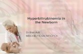 Hyperbilirubinemia in the Newborn - Al-Mustansiriya University 10_54_57_AM.pdf · PDF fileDr.Ban Adil MBCHB,FICSM,MRCPCh . JAUNDICE (ICTERUS). • Def.:Yellow discoloration of the
