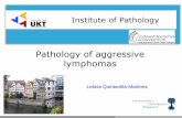 Pathology of aggressive lymphomas - oncologypro.esmo.org · •Aggressive B-cell lymphoid neoplasms –Major changes that impact how cases should be evaludated and diagnosed (pathologist)