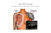 Het PECS block - uzleuven.be PECS... · PECS 1: BORST regio. (vb.tumorectomies) PECS 1+2: BORST + OKSEL regio (vb. ME+/- OE, TOS, ICD). Techniek: WAAR. Anatomie : 1. Lateral Pectoral
