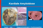 Kardiale Amyloidose - carsten- Einfacher Diagnose Score zur Differentialdiagnose der LVH Kardiale Amyloidose