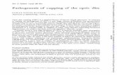 J. Pathogenesis of cupping of the optic disc - bjo.bmj.com · Brit. J. Ophthal. (I974) 58, 863 Pathogenesis of cupping of the optic disc SOHANSINGHHAYREH Department ofOphthalmology,