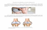 Rysunek 1: Bolesność stawu kolanowego w …azmmedical.pl/pdf/artykul_stawy_kolanowe.pdfChoroba zwyrodnieniowa stawów kolanowych Choroba zwyrodnieniowa stawów kolanowych, czyli