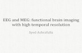 EEG and MEG: Functional Brain Imaging with High Temporal ... EEG and MEG: functional brain imaging with