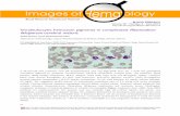 Intraleukocytic hemozoin pigments in complicated ......revealed abundant intraerythrocytic Plasmodium falciparum trophozoites and numerous brown, birefringent, cytoplasmic inclusions