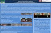 Peters Anomaly - Strabismus and Amblyopia: a …...Peters, Anomaly - Strabismus and Amblyopia: a case report Ilda Maria Poças1, Pedro Miguel Lino2, Inês Abrantes3 1 Orthoptist. Specialist