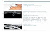 Shoulder Protocol - SonoSkills · Humeroulnar joint, humeroulnar joint space, posterior olecranon recess, hyaline cartilage of trochlea, olecranon fossa and fat pad, olecranon bursa.