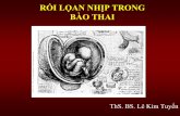 RỐI LỌAN NHỊP TRONG BÀO THAItimmachhongtam.com/tailieusieuamtimthai/roi_loan_nhip...1.ĐỊNH NGHĨA 2.DIỄN TIẾN NHỊP TIM THAI BÌNH THƯỜNG 3.CÁC PHƯƠNG PHÁP ĐÁNH