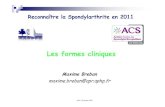 ACS 26 mars 2011 · Reconnaître la Spondylarthrite en 2011 Les formes cliniques ACS 26 mars 2011 Maxime Breban maxime.breban@apr.aphp.fr