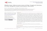Müllerian Adenosarcoma of the Vaginal Stump: A Case Report and Literature Review · 2018-11-23 · dysmenorrhea was aggravating, and the patient was diagnosed as endometriosis .