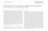 p63 expression in benign and malignant breast lesions · immunohistochemical expression and distribution pattern of p63, in benign and malignant breast lesions, and compared it with
