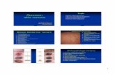 Common - Mahidol · Fibrous papule Pearly penile papule Acral fibrokeratoma Dermatofibroma Dermatofibroma Hyperpigmented firm papule 0.5-2 cm. Lipoma Lipoma : most common soft-tissue