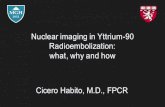 Nuclear imaging in Yttrium-90 Radioembolization: what, why ... · PDF file and planar nuclear imaging • SPECT/CT reveals extrahepatic 99mTc-MAA particle deposition missed on angiography,