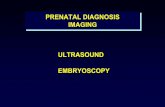 Prenatal diagnosis - Imaging · prenatal diagnosis imaging ultrasound. embryoscopy. fetal medicine ultrasound imaging fetal medicine ultrasound imaging. dating. multiple pregnancy.
