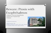 Beware: Ptosis with Exophthalmos367c6d894dcc3819de9b-be38adc8b929036a793b521054b93816.r34.cf1.rackc… · Beware: Ptosis with Exophthalmos A rearview perspective . Wade Reardon, MD
