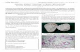 INGUINAL BREAST TISSUE WITH FIBROCYSTIC …...highlight the fact that accessory breast tissue with fibrocystic disease must be considered amongst the differential diagnosis of inguinal