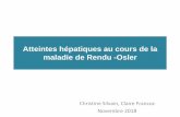 Atteintes hépatiques au cours de la maladie de Rendu -Osler · 2019-02-25 · Introduction Maladie de Rendu-Osler-Weber ou télangiectasie hémorragique héréditaire (THH) •Maladie