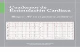Cuadernos de Estimulación Cardiaca Nº 13secardiologia.es/images/stories/secciones/estimulacion/... · 2014-10-23 · Cuadernos de Estimulación Cardiaca Javier Alzueta Rodríguez
