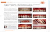 A L R TIGO O R I G I N REMODELAÇÃO DO BIÓTIPO GENGIVAL ...³pia.pdf · lógico de regeneração periodontal constituído por proteínas derivadas da matriz de esmalte (EMDOGAIN®)