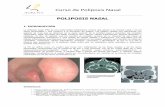 Curso de Poliposis Nasal - SEORL · PDF file 2015-09-11 · Curso de Poliposis Nasal PN, a los que se les realizaron diversas investigaciones alérgicas, Bunnang y cols (15) encuentran
