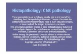 Histopathology: CNS pathology - Rated Medicine · Histopathology: CNS pathology These presentations are to help you identify, and to test yourself on identifying, basic histopathological