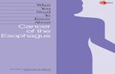 Cancer of the Esophagus - CancerQuest · Cancer of the Esophagus he diagnosis of cancer of the esophagus brings with it many questions and a need for clear, understandable answers.