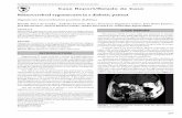 Rhinocerebral zygomycosis in a diabetic patient · Torres-Narbona M, Guinea J, Muñoz P, Bouza E. Zigomicetos y zigomicosis en la era de las nuevas terapias antifúngicas. Rev Esp