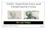 G20A: Superficial Face and Infratemporal Fossa Morton.ppt.pdfA patient suffers a lesion to the nerve within her right stylomastoid foramen inhibiting the function of this nerve. A.