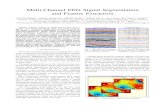 Multi-Channel EEG Signal Segmentation and Feature Multi-Channel EEG Signal Segmentation and Feature