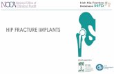 HIP FRACTURE IMPLANTS - Amazon S3s3-eu-west-1.amazonaws.com/noca-uploads/general/12... · Cemented Polished Exeter Trilliance Matt Charnley Excia Uncemented Proximally Coated Trilock