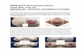 BREAST Reconstruction And the use of MEDICAL MICRO ... · PDF file surgery or breast augmentation and as such the aesthetics of reconstruction after breast cancer can vary due to adjuvant