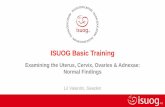 ISUOG Basic Training · ISUOG’s basic training curriculum Key points THE BASIS for gynecological ultrasound •Orientate yourself in the image •Optimize your image •Always use
