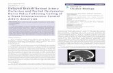 Avens Publishing Group Journal of ing Innova ions t …...segment exam and the dilated fundus exam were unremarkable. No cranial nerve deficits were seen. Repeat angiography revealed