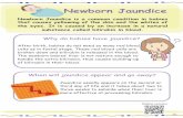 Newborn Jaundice - fhs.gov.hk · PDF file Newborn Jaundice Newborn Jaundice is a common condition in babies Why do babies have jaundice? After birth, babies do not need so many red