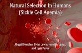 Abigail Morales, Tyler Lewis, Jennifer Lopez, …...Natural Selection In Humans (Sickle Cell Anemia) Abigail Morales, Tyler Lewis, Jennifer Lopez, and Irais Perez Background Information