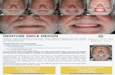 DENTURE SMILE DESIGN - 3dprecisiondigital.com · denture smile design through the application of esthetic smile design principles we are taking denture fabrication to the next level