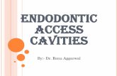 ENDODONTIC ACCESS CAVITIESsdcri.in/sgi/wp-content/uploads/2018/01/Acess-opening-by-dr.-Renu.p… · Access cavity preparation is defined as endodontic coronal preparation which enables