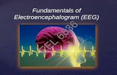 Fundamentals of Electroencephalogram (EEG)web.eng.fiu.edu/mcabre05/DATA FOR PROJECTS/class eeg-FALL-2018-1_36_to_print.pdf Electroencephalogram (EEG) EEG showing Epileptiform activity