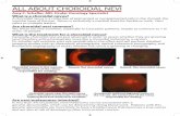 ALL ABOUT CHOROIDAL NEVI › media › pages › ... · ALL ABOUT CHOROIDAL NEVI Amy C. Schefler, MD, Ocular Oncology Specialist Are nevi/melanomas inherited? In less than 5% of patients,