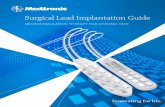 Surgical Lead Implant Tech Guide - Neurosurgery Residentneurosurgeryresident.net/Op. Operative Techniques... · The Neurostimulation Therapy for Chronic Pain Surgical Lead Implantation